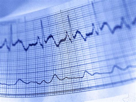 how hard should heart pump in style advanced rest test|10 heart tests your doctor might order.